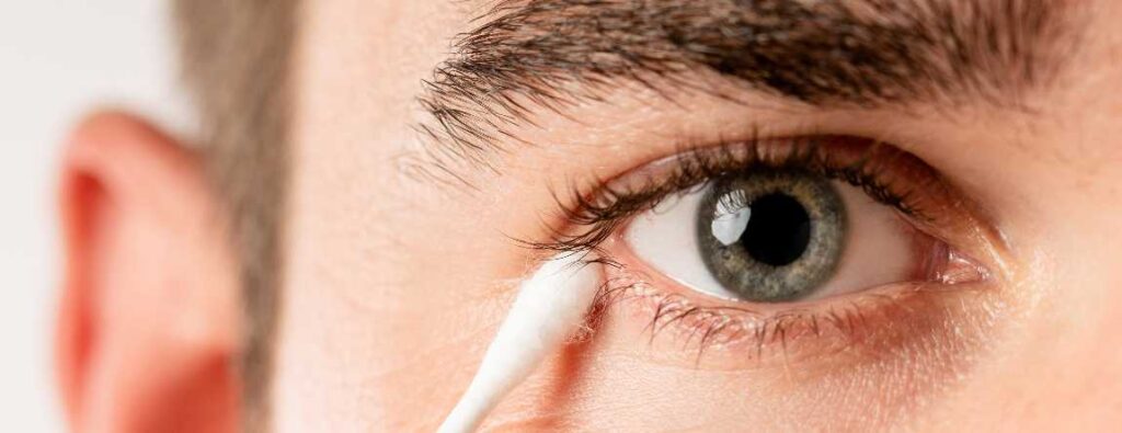 Limpieza de párpados, blefaritis y orzuelos: consejos útiles 7 Limpieza parpados blefaritis orzuelo
