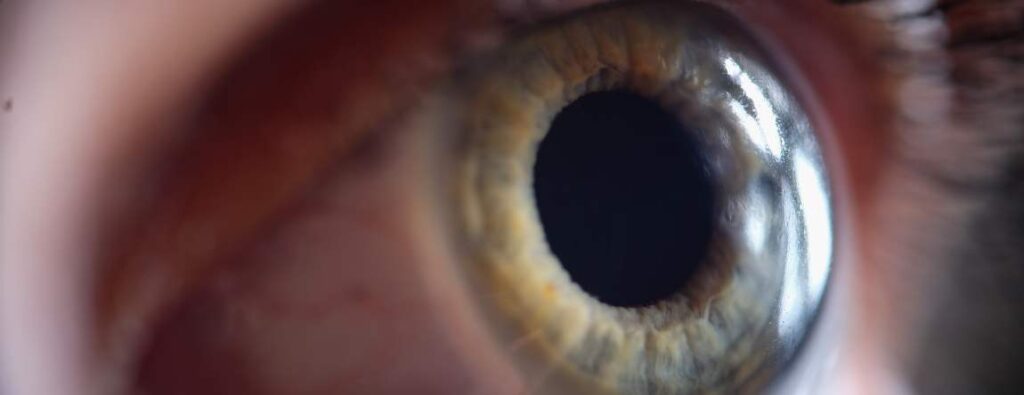 ¿Qué es una distrofia corneal? Causas y soluciones 28 Ojo con lentilla