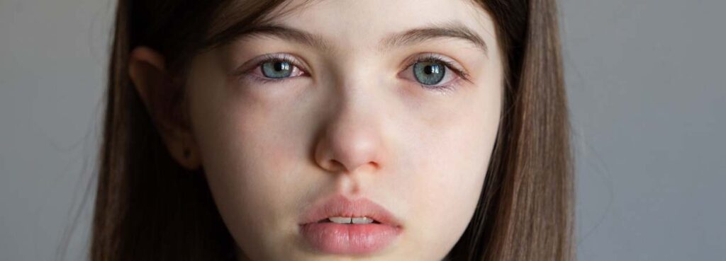 Problemas en los ojos por gripe o coronavirus 18 problemas ojos gripe coronavirus